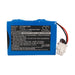 Philips M1722A B M1723A B M1724XE M1722B Medical Replacement Battery